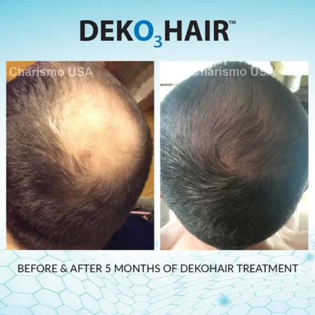 DEKO_Hair_results