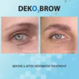 DEKO_Brow_Results