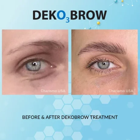 DEKO_Brow_Results